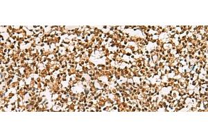 Immunohistochemistry of paraffin-embedded Human tonsil tissue using PHF5A Polyclonal Antibody at dilution of 1:55(x200) (PHF5A antibody)