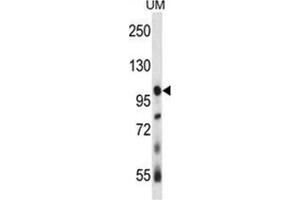 USP4 Antibody (N-term) western blot analysis in human uterine tumor tissue lysates (35 µg/lane).