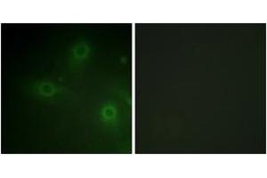 Immunofluorescence analysis of HeLa cells, using p47 phox (Ab-304) Antibody. (NCF1 antibody  (AA 281-330))
