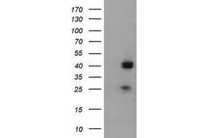 Western Blotting (WB) image for anti-alpha-1,4-N-Acetylglucosaminyltransferase (A4GNT) (AA 121-340) antibody (ABIN2715585) (A4GNT antibody  (AA 121-340))