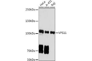 Western blot analysis of extracts of various cell lines, using VPS11 Rabbit mAb (ABIN7271272) at 1:1000 dilution. (VPS11 antibody)