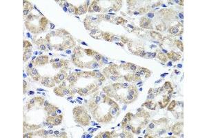 Immunohistochemistry of paraffin-embedded Human stomach using MAPKBP1 Polyclonal Antibody at dilution of 1:100 (40x lens).