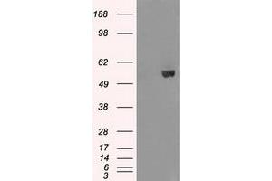 HEK293T cells were transfected with the pCMV6-ENTRY control (Left lane) or pCMV6-ENTRY AKT2 (Right lane) cDNA for 48 hrs and lysed. (AKT2 antibody)