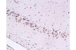 Formalin-fixed and paraffin embedded rat brain tissue labeled with Anti-Cygb Polyclonal Antibody , Unconjugated at 1:200, followed by conjugation to the secondary antibody and DAB staining (CYGB antibody  (AA 87-132))