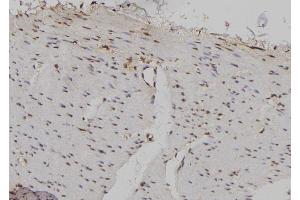 ABIN6276998 at 1/100 staining Human gastric tissue by IHC-P. (Importin 5 antibody)