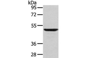 Western Blot analysis of Mouse lung tissue using WASF2 Polyclonal Antibody at dilution of 1/200 (WASF2 antibody)