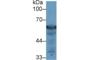 Detection of FGB in Rat Liver lysate using Polyclonal Antibody to Fibrinogen Beta Chain (FGB) (Fibrinogen beta Chain antibody  (AA 49-495))