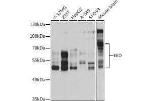 Western blot analysis of extracts of various cell lines, using EED antibody (ABIN6127866, ABIN6139942, ABIN6139945 and ABIN6221014) at 1:1000 dilution. (EED antibody  (AA 1-300))