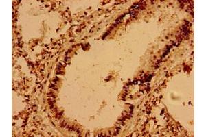 Immunohistochemistry of paraffin-embedded human lung tissue using ABIN7175485 at dilution of 1:100