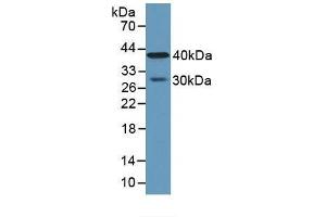 Detection of CPA4 in Human Lung Tissue using Polyclonal Antibody to Carboxypeptidase A4 (CPA4) (CPA4 antibody  (AA 55-421))