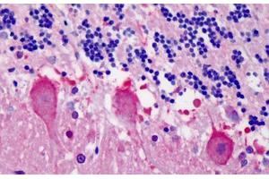 Human Cerebellum: Formalin-Fixed, Paraffin-Embedded (FFPE) (YWHAB antibody  (AA 34-221))