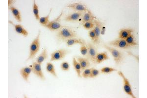 Immunohistochemistry (IHC) image for anti-Fatty Acid Synthase (FASN) (AA 1-226) antibody (ABIN3044520)