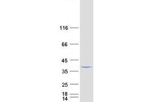 Western Blotting (WB) image for V-Crk Sarcoma Virus CT10 Oncogene Homolog (Avian) (CRK) (Transcript Variant 2) protein (Myc-DYKDDDDK Tag) (ABIN2712560)