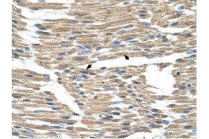 GPR177 antibody was used for immunohistochemistry at a concentration of 4-8 ug/ml to stain Skeletal muscle cells (arrows) in Human Muscle.