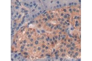 IHC-P analysis of Human Tissue, with DAB staining. (GRO gamma antibody  (AA 35-107))