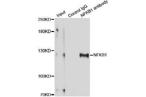 Immunoprecipitation analysis of 150 μg extracts of MCF-7 cells using 3 μg NFKB1 antibody (ABIN5998332). (NFKB1 antibody)