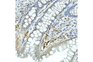 Immunohistochemistry of paraffin-embedded human esophagus using CDK1 Rabbit mAb (ABIN7266576) at dilution of 1:100 (40x lens). (CDK1 antibody)
