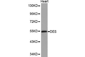 Western blot analysis of extracts of mouse heart, using DES antibody (ABIN5970272). (Desmin antibody)