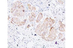 IHC analysis of PDCD6IP using anti-PDCD6IP antibody (ABIN7600490).