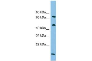 WB Suggested Anti-ECD Antibody Titration: 0. (ECD/SGT1 antibody  (Middle Region))