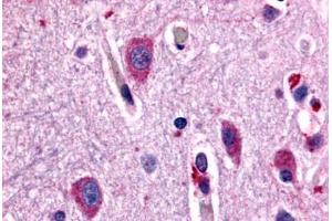 Anti-CHRM2 antibody  ABIN1048438 IHC staining of human brain, neurons and glia. (Muscarinic Acetylcholine Receptor M2 antibody  (Cytoplasmic Domain))