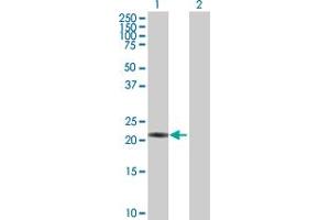 Western Blot analysis of PSMB3 expression in transfected 293T cell line by PSMB3 MaxPab polyclonal antibody. (PSMB3 antibody  (AA 1-205))