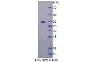 SDS-PAGE analysis of Rat PLCb2 Protein. (Phospholipase C beta 2 Protein)