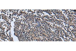 Immunohistochemistry of paraffin-embedded Human tonsil tissue using WNT9B Polyclonal Antibody at dilution of 1:85(x200) (WNT9B antibody)