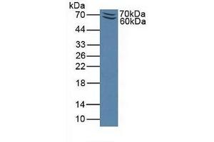 Detection of Recombinant PSGL1, Mouse using Polyclonal Antibody to P-Selectin Glycoprotein Ligand 1 (PSGL1) (SELPLG antibody  (AA 94-345))