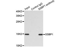 Immunoprecipitation analysis of 200 μg extracts of MCF7 cells using 1 μg SSBP1 antibody (ABIN5974202). (SSBP1 antibody)