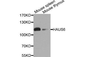 Western blot analysis of extracts of various cell lines, using HAUS6 antibody. (FAM29A antibody)