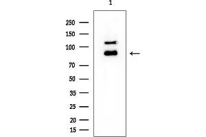 Western blot analysis of lysates from EC304 cells, using STAT1 Mouse Monoclonal Antibody at 1/1000 dilution.