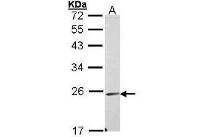 WB Image Sample (30 ug of whole cell lysate) A: A431 , 12% SDS PAGE antibody diluted at 1:1000 (Endomucin antibody)