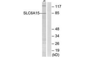 Western blot analysis of extracts from Jurkat cells, using SLC6A15 Antibody. (SLC6A15 antibody  (AA 32-81))