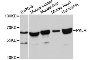 Western blot analysis of extracts of various cell lines, using PKLR antibody (ABIN5998530) at 1:3000 dilution. (PKLR antibody)