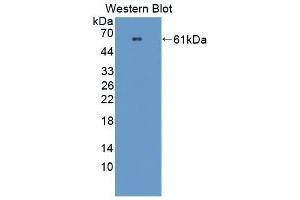 Detection of Recombinant PRCP, Mouse using Polyclonal Antibody to Prolylcarboxypeptidase (PRCP) (PRCP antibody  (AA 169-443))