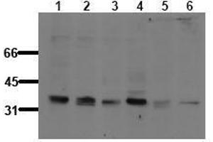 Western Blotting (WB) image for anti-B-Cell CLL/lymphoma 10 (BCL10) (pSer138) antibody (ABIN126733) (BCL10 antibody  (pSer138))