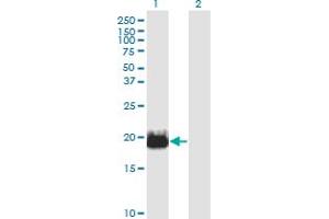 Western Blot analysis of IFT20 expression in transfected 293T cell line by IFT20 monoclonal antibody (M02), clone 3F3. (IFT20 antibody  (AA 1-148))
