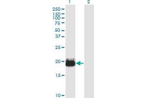 Western Blot analysis of IFT20 expression in transfected 293T cell line by IFT20 monoclonal antibody (M02), clone 3F3. (IFT20 antibody  (AA 1-148))