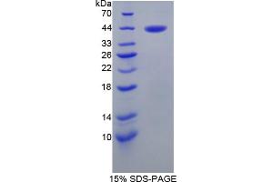 Image no. 1 for serpin Peptidase Inhibitor, Clade B (Ovalbumin), Member 6 (SERPINB6) (AA 1-376) protein (His tag) (ABIN6237425) (SERPINB6 Protein (AA 1-376) (His tag))