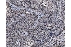 IHC analysis of SAP18 using anti-SAP18 antibody (ABIN7599009).