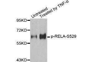 Western Blotting (WB) image for anti-Nuclear Factor-kB p65 (NFkBP65) (pSer529) antibody (ABIN1870581) (NF-kB p65 antibody  (pSer529))