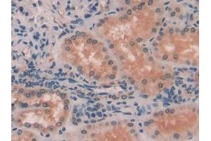 Detection of MYLK in Human Kidney Tissue using Polyclonal Antibody to Myosin Light Chain Kinase (MYLK) (MYLK antibody  (AA 1661-1877))