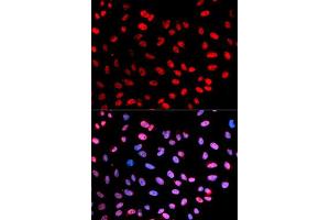 Immunofluorescent staining of U-2 OS cells with ESPL1 (phospho S1126) polyclonal antibody  at 1:20-1:100 dilution. (Separase antibody  (pSer1126))