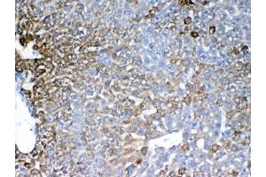 Immunohistochemistry (IHC) image for anti-Insulin-Like Growth Factor Binding Protein 1 (IGFBPI) antibody (ABIN5647581)