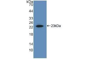 Detection of Recombinant MMP1, Human using Polyclonal Antibody to Matrix Metalloproteinase 1 (MMP1) (MMP1 antibody  (AA 98-275))