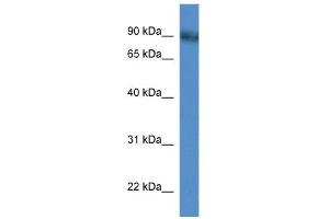 WB Suggested Anti-Pde4d Antibody Titration: 0. (PDE4D antibody  (N-Term))