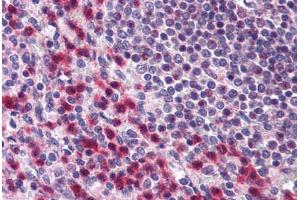 Human Spleen (formalin-fixed, paraffin-embedded) stained with BCLAF1 antibody ABIN296759 at 10 ug/ml followed by biotinylated goat anti-rabbit IgG secondary antibody ABIN481713, alkaline phosphatase-streptavidin and chromogen. (BCLAF1 antibody  (AA 700-750))