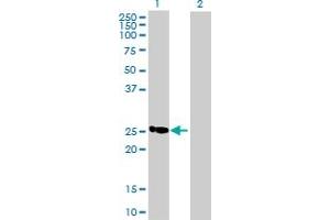 Western Blot analysis of C19orf43 expression in transfected 293T cell line by C19orf43 MaxPab polyclonal antibody. (C19orf43 antibody  (AA 1-176))
