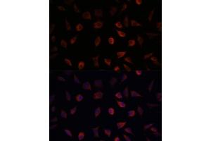 Immunofluorescence analysis of L929 cells using F antibody (ABIN6131636, ABIN6140414, ABIN6140415 and ABIN6220935) at dilution of 1:100. (FABP1 antibody  (AA 1-127))